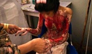 La foto de Marzia que le valió en 2003 el prestigiado premio World Press Photo, dentro de la categoría “International Issues” a Stephanie Sinclair.